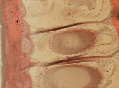 Lumbricus terrestris