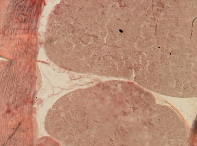Lumbricus terrestris