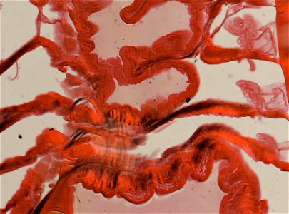 Lumbricus terrestris
