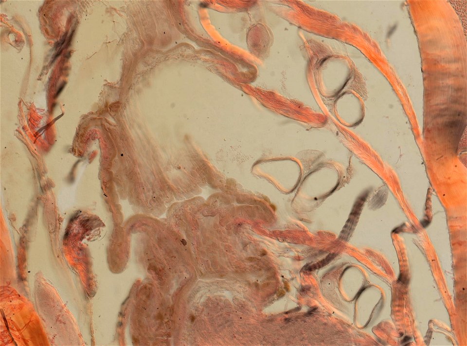Lumbricus terrestris