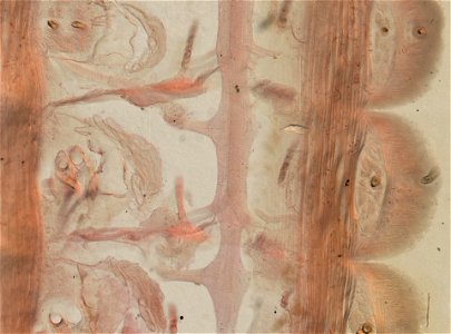 Lumbricus terrestris