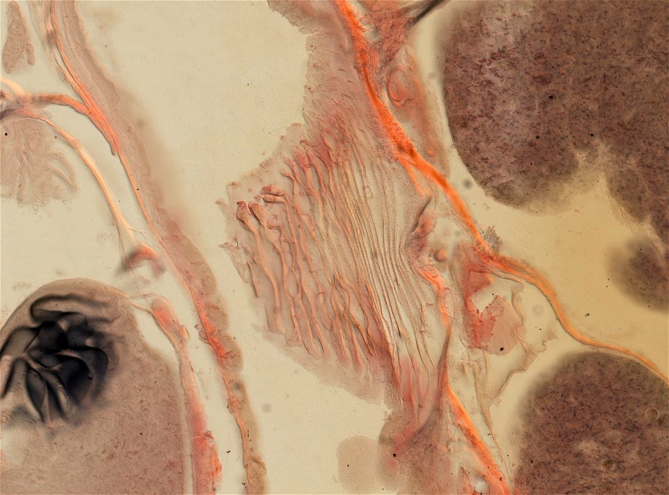 Lumbricus terrestris