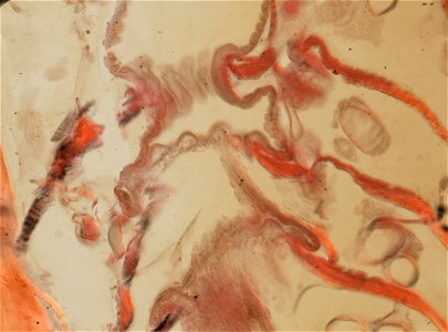 Lumbricus terrestris