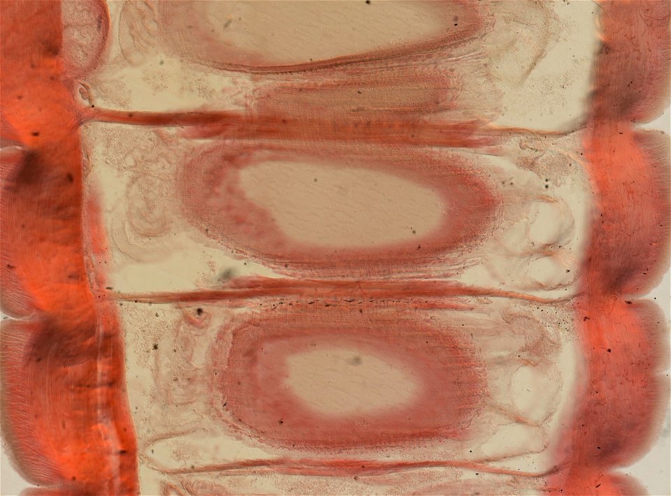 Lumbricus terrestris