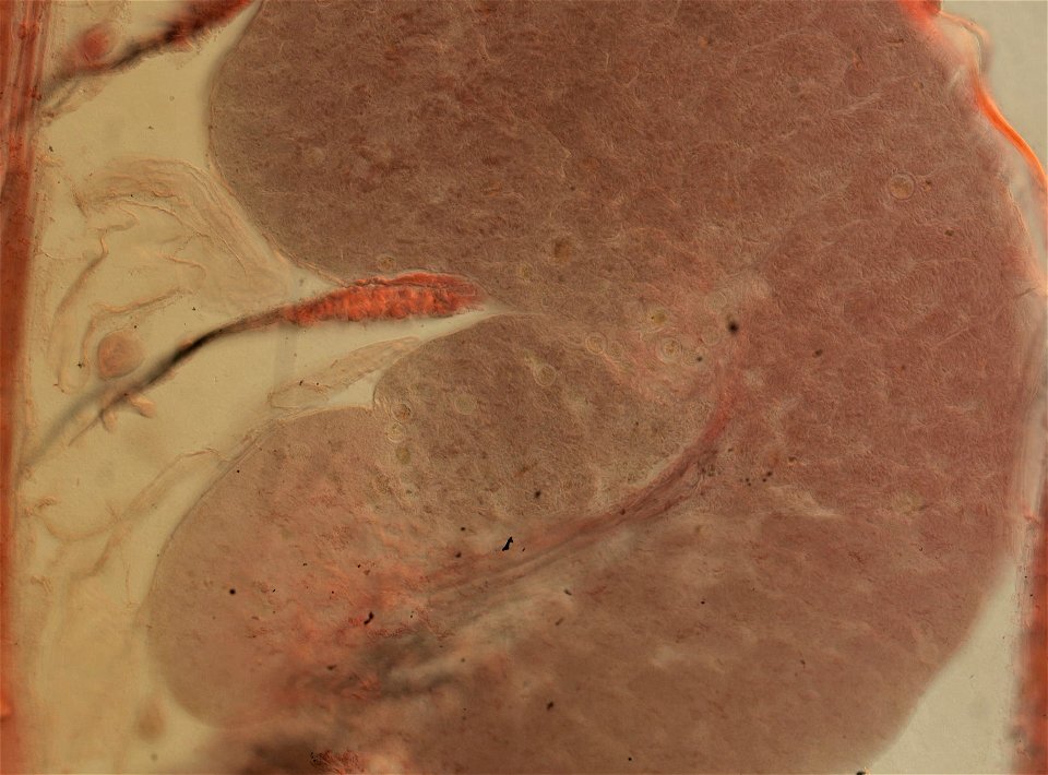 Lumbricus terrestris