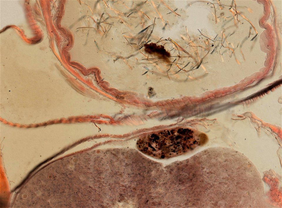 Lumbricus terrestris