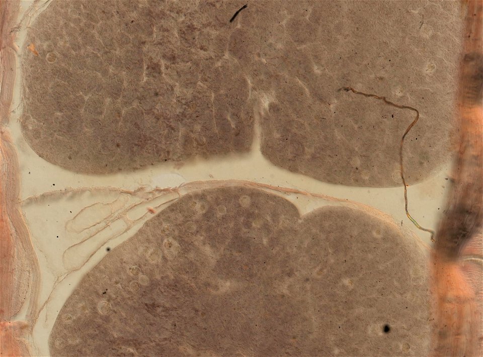 Lumbricus terrestris