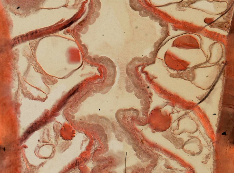 Lumbricus terrestris