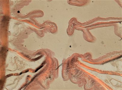 Lumbricus terrestris