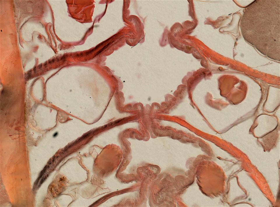 Lumbricus terrestris