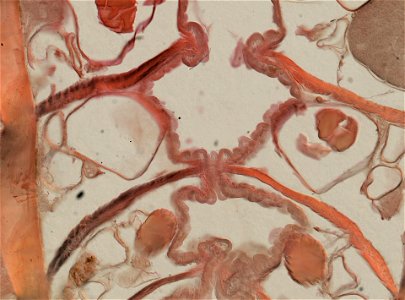Lumbricus terrestris