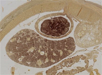 Lumbricus terrestris