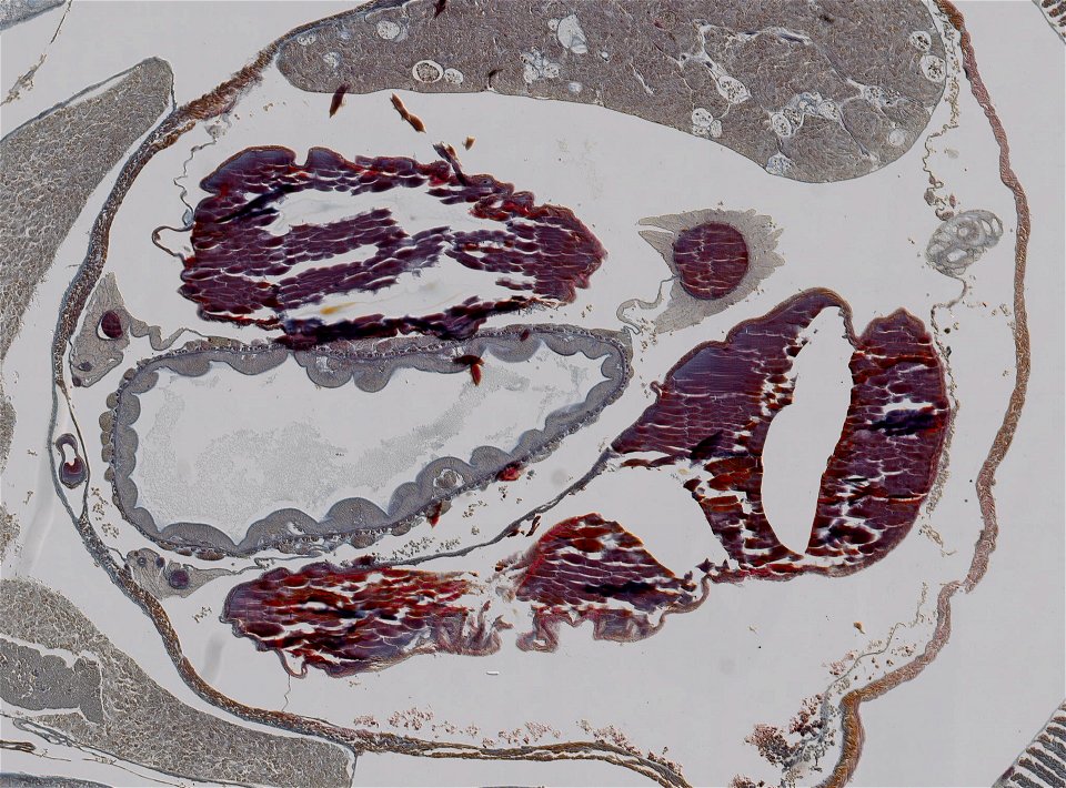 Lumbricus terrestris