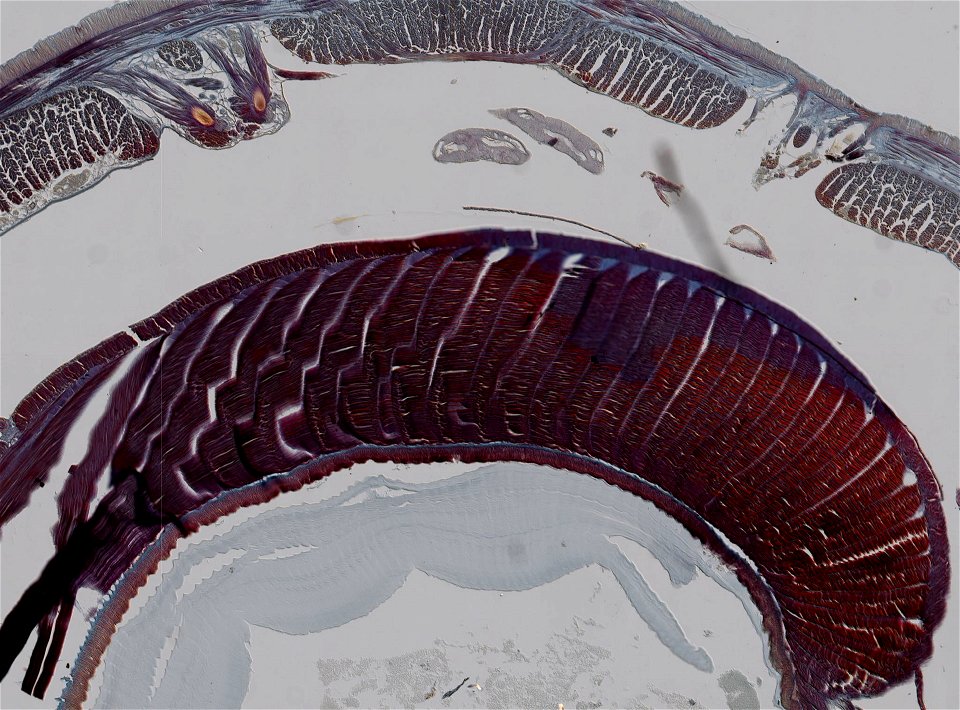 Lumbricus terrestris