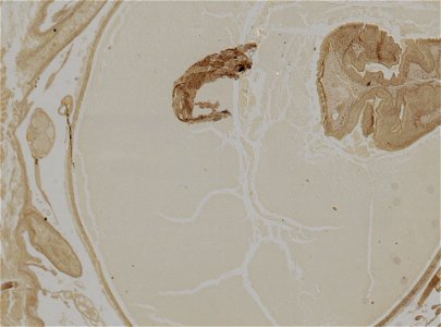 Lumbricus terrestris
