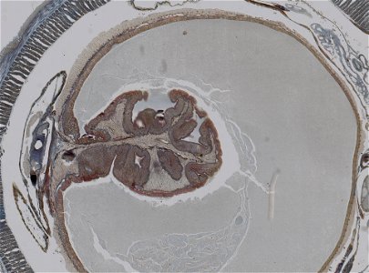 Lumbricus terrestris