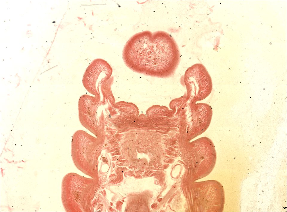 Lumbricus terrestris