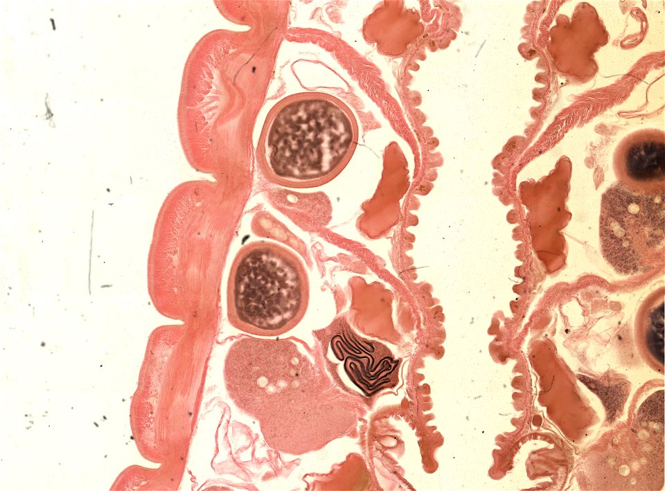 Lumbricus terrestris