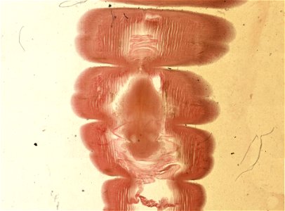 Lumbricus terrestris