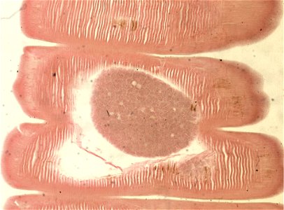 Lumbricus terrestris