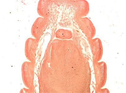Lumbricus terrestris