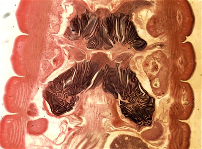 Lumbricus terrestris