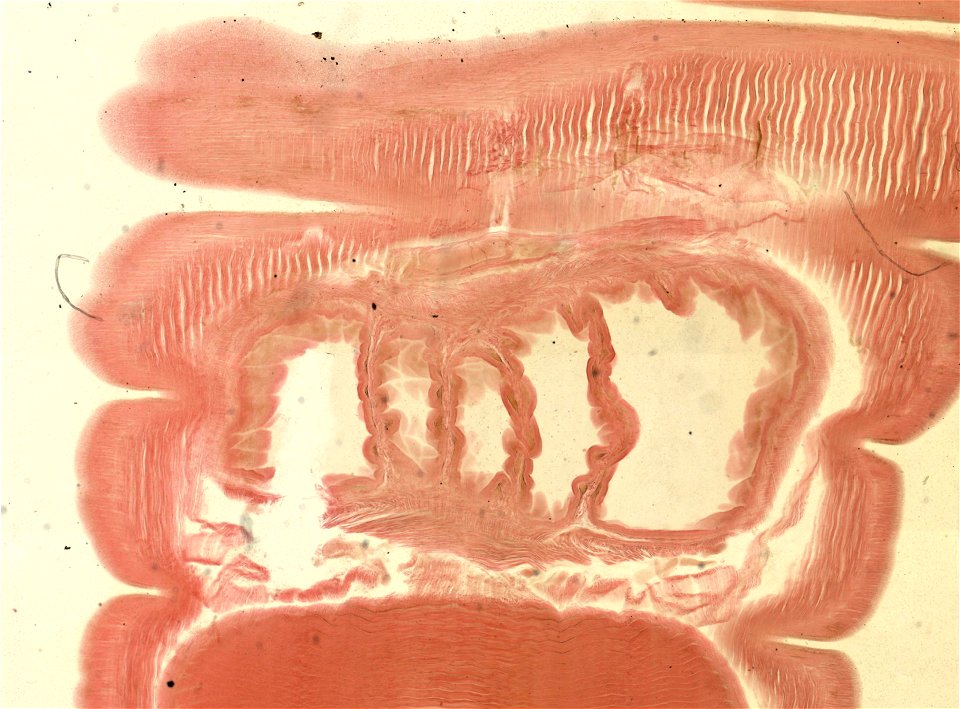 Lumbricus terrestris