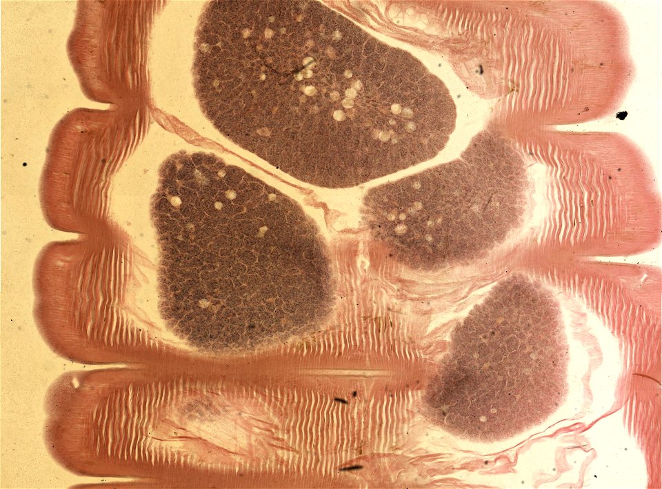 Lumbricus terrestris