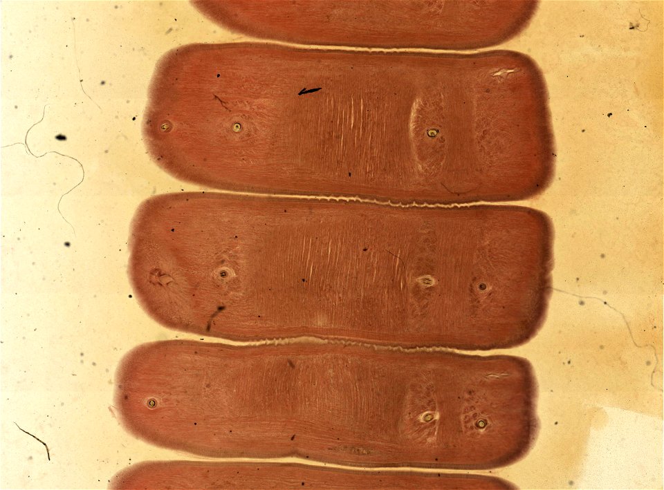 Lumbricus terrestris