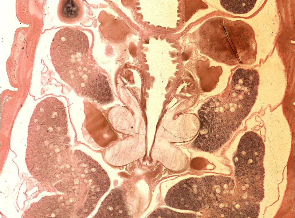 Lumbricus terrestris