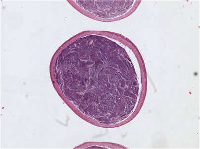 Lumbricus terrestris