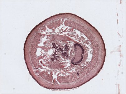 Lumbricus terrestris