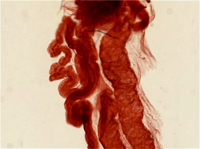 Lumbricus terrestris