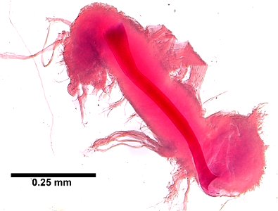 PRESERVED_SPECIMEN; ; ; microslide; CSBR Slide Grant Image 2015; Gray Museum; IZ number 72296; lot count 2; Microslide 01, whole mount; other number GM 5292; 1967-08-15T00:00:00Z