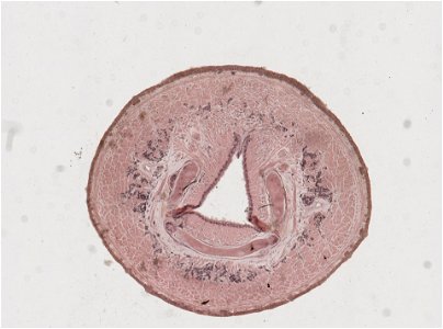 PRESERVED_SPECIMEN; ; ; microslide; IZ number 98093; lot count 1; Microslide 01, balsam, serial section;