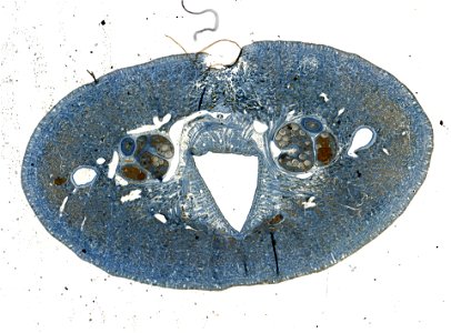 PRESERVED_SPECIMEN; ; ; microslide; IZ number 98104; lot count 1; Microslide 01, balsam, serial section;