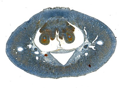 PRESERVED_SPECIMEN; ; ; microslide; IZ number 98103; lot count 1; Microslide 01, balsam, serial section;