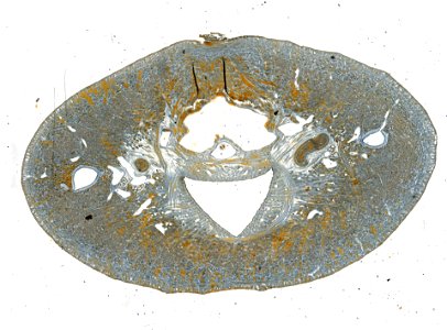 PRESERVED_SPECIMEN; ; ; microslide; IZ number 98105; lot count 1; Microslide 01, balsam, serial section;