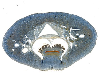 PRESERVED_SPECIMEN; ; ; microslide; IZ number 98111; lot count 1; Microslide 01, balsam, serial section;