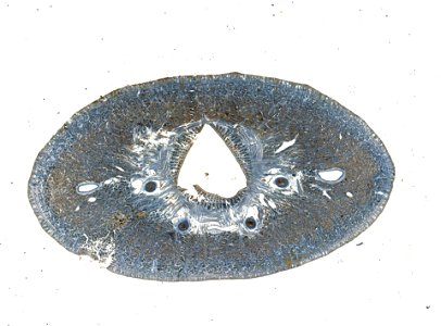 PRESERVED_SPECIMEN; ; ; microslide; IZ number 98112; lot count 1; Microslide 01, balsam, serial section;