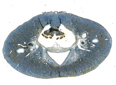 PRESERVED_SPECIMEN; ; ; microslide; IZ number 98113; lot count 1; Microslide 01, balsam, serial section;