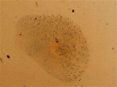 PRESERVED_SPECIMEN; ; ; microslide; IZ number 96987; lot count 1; Microslide 01, glycerin, parapodia; Microslide 01, glycerin, elytra; other number 31;