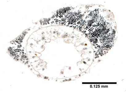 PRESERVED_SPECIMEN; ; ; microslide; Cnidaria demo; IZ number 77030; lot count 1; Microslide 01, balsam, thin section;