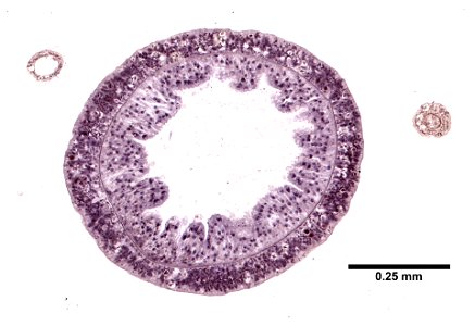 PRESERVED_SPECIMEN; ; ; microslide; Cnidaria demo; IZ number 77100; lot count 1; Microslide 01, balsam, thin section;