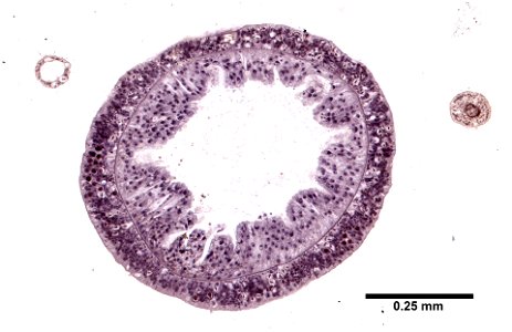 PRESERVED_SPECIMEN; ; ; microslide; Cnidaria demo; IZ number 77100; lot count 1; Microslide 01, balsam, thin section;