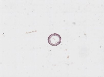 PRESERVED_SPECIMEN; ; ; microslide; IZ number 91798; lot count 1; Microslide 01, balsam, cross section;