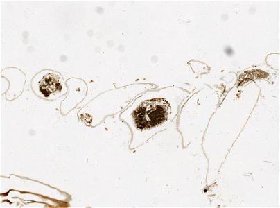 PRESERVED_SPECIMEN; ; ; microslide; IZ number 97762; lot count 1; Microslide 01, balsam, serial section; Microslide 02, balsam, serial section; Microslide 03, balsam, serial section; Microsl