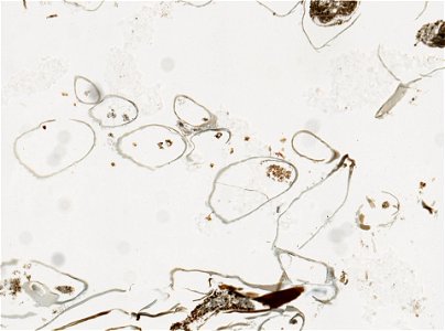PRESERVED_SPECIMEN; ; ; microslide; IZ number 97762; lot count 1; Microslide 01, balsam, serial section; Microslide 02, balsam, serial section; Microslide 03, balsam, serial section; Microsl