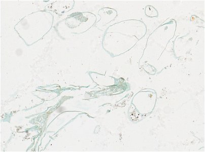PRESERVED_SPECIMEN; ; ; microslide; IZ number 97762; lot count 1; Microslide 01, balsam, serial section; Microslide 02, balsam, serial section; Microslide 03, balsam, serial section; Microsl