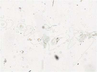 PRESERVED_SPECIMEN; ; ; microslide; IZ number 97762; lot count 1; Microslide 01, balsam, serial section; Microslide 02, balsam, serial section; Microslide 03, balsam, serial section; Microsl